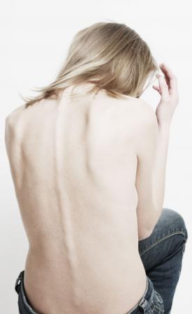 Objawem klasyfikującym anoreksję u kobiet jest zatrzymanie miesiączkowania. 