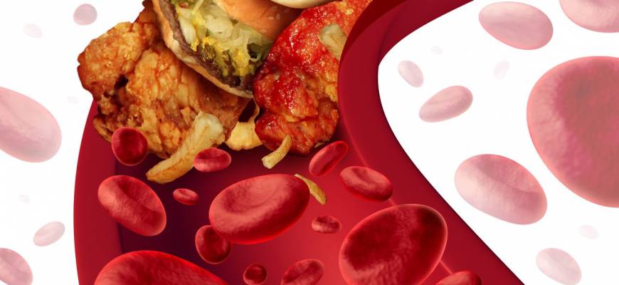 Wysoki cholesterol - jak skutecznie go obniżyć?