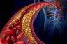 Hiperlipidemia mieszana. Objawy, leczenie i odpowiednia dieta
