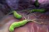 Helicobacter pylori i jej związek z anemią