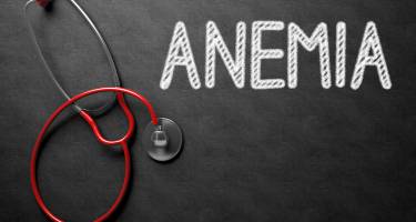 Anemia perniciosa, czyli objawy i leczenie niedokrwistości Addisona-Biermera