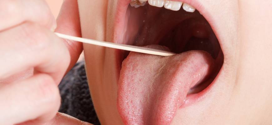 Mononukleoza u dzieci – objawy, leczenie, dieta Mononukleoza u dzieci – objawy, leczenie, dieta
